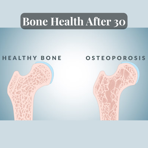 Bone Health After 30: What Most People Ignore